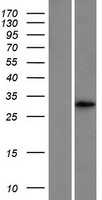 Western blot validation of overexpression lysate (Cat# LY415826) using anti-DDK antibody (Cat# TA50011-100). Left: Cell lysates from un-transfected HEK293T cells; Right: Cell lysates from HEK293T cells transfected with RC205241 using transfection reagent MegaTran 2.0 (Cat# TT210002).