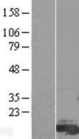 Western blot validation of overexpression lysate (Cat# LY407488) using anti-DDK antibody (Cat# TA50011-100). Left: Cell lysates from un-transfected HEK293T cells; Right: Cell lysates from HEK293T cells transfected with RC205443 using transfection reagent MegaTran 2.0 (Cat# TT210002).