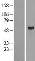 Western blot validation of overexpression lysate (Cat# LY407960) using anti-DDK antibody (Cat# TA50011-100). Left: Cell lysates from un-transfected HEK293T cells; Right: Cell lysates from HEK293T cells transfected with RC205498 using transfection reagent MegaTran 2.0 (Cat# TT210002).