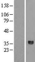 Western blot validation of overexpression lysate (Cat# LY407512) using anti-DDK antibody (Cat# TA50011-100). Left: Cell lysates from un-transfected HEK293T cells; Right: Cell lysates from HEK293T cells transfected with RC205453 using transfection reagent MegaTran 2.0 (Cat# TT210002).