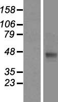 Western blot validation of overexpression lysate (Cat# LY413885) using anti-DDK antibody (Cat# TA50011-100). Left: Cell lysates from un-transfected HEK293T cells; Right: Cell lysates from HEK293T cells transfected with RC205211 using transfection reagent MegaTran 2.0 (Cat# TT210002).