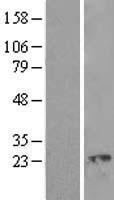 Western blot validation of overexpression lysate (Cat# LY410431) using anti-DDK antibody (Cat# TA50011-100). Left: Cell lysates from un-transfected HEK293T cells; Right: Cell lysates from HEK293T cells transfected with RC205543 using transfection reagent MegaTran 2.0 (Cat# TT210002).