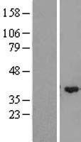 Western blot validation of overexpression lysate (Cat# LY410269) using anti-DDK antibody (Cat# TA50011-100). Left: Cell lysates from un-transfected HEK293T cells; Right: Cell lysates from HEK293T cells transfected with RC205404 using transfection reagent MegaTran 2.0 (Cat# TT210002).
