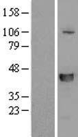 Western blot validation of overexpression lysate (Cat# LY408129) using anti-DDK antibody (Cat# TA50011-100). Left: Cell lysates from un-transfected HEK293T cells; Right: Cell lysates from HEK293T cells transfected with RC205566 using transfection reagent MegaTran 2.0 (Cat# TT210002).