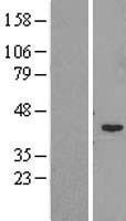 Western blot validation of overexpression lysate (Cat# LY407067) using anti-DDK antibody (Cat# TA50011-100). Left: Cell lysates from un-transfected HEK293T cells; Right: Cell lysates from HEK293T cells transfected with RC205596 using transfection reagent MegaTran 2.0 (Cat# TT210002).