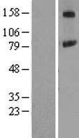 Western blot validation of overexpression lysate (Cat# LY406118) using anti-DDK antibody (Cat# TA50011-100). Left: Cell lysates from un-transfected HEK293T cells; Right: Cell lysates from HEK293T cells transfected with RC205334 using transfection reagent MegaTran 2.0 (Cat# TT210002).