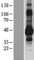 Western blot validation of overexpression lysate (Cat# LY424216) using anti-DDK antibody (Cat# TA50011-100). Left: Cell lysates from un-transfected HEK293T cells; Right: Cell lysates from HEK293T cells transfected with RC205403 using transfection reagent MegaTran 2.0 (Cat# TT210002).