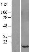 Western blot validation of overexpression lysate (Cat# LY410096) using anti-DDK antibody (Cat# TA50011-100). Left: Cell lysates from un-transfected HEK293T cells; Right: Cell lysates from HEK293T cells transfected with RC221009 using transfection reagent MegaTran 2.0 (Cat# TT210002).