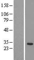 Western blot validation of overexpression lysate (Cat# LY409060) using anti-DDK antibody (Cat# TA50011-100). Left: Cell lysates from un-transfected HEK293T cells; Right: Cell lysates from HEK293T cells transfected with RC205472 using transfection reagent MegaTran 2.0 (Cat# TT210002).