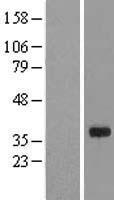 Western blot validation of overexpression lysate (Cat# LY423421) using anti-DDK antibody (Cat# TA50011-100). Left: Cell lysates from un-transfected HEK293T cells; Right: Cell lysates from HEK293T cells transfected with RC205575 using transfection reagent MegaTran 2.0 (Cat# TT210002).