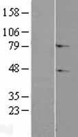Western blot validation of overexpression lysate (Cat# LY406931) using anti-DDK antibody (Cat# TA50011-100). Left: Cell lysates from un-transfected HEK293T cells; Right: Cell lysates from HEK293T cells transfected with RC206167 using transfection reagent MegaTran 2.0 (Cat# TT210002).