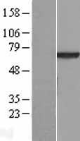 Western blot validation of overexpression lysate (Cat# LY416097) using anti-DDK antibody (Cat# TA50011-100). Left: Cell lysates from un-transfected HEK293T cells; Right: Cell lysates from HEK293T cells transfected with RC206027 using transfection reagent MegaTran 2.0 (Cat# TT210002).