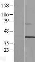 Western blot validation of overexpression lysate (Cat# LY410408) using anti-DDK antibody (Cat# TA50011-100). Left: Cell lysates from un-transfected HEK293T cells; Right: Cell lysates from HEK293T cells transfected with RC206140 using transfection reagent MegaTran 2.0 (Cat# TT210002).