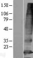 Western blot validation of overexpression lysate (Cat# LY407559) using anti-DDK antibody (Cat# TA50011-100). Left: Cell lysates from un-transfected HEK293T cells; Right: Cell lysates from HEK293T cells transfected with RC206215 using transfection reagent MegaTran 2.0 (Cat# TT210002).