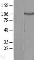 Western blot validation of overexpression lysate (Cat# LY410255) using anti-DDK antibody (Cat# TA50011-100). Left: Cell lysates from un-transfected HEK293T cells; Right: Cell lysates from HEK293T cells transfected with RC206168 using transfection reagent MegaTran 2.0 (Cat# TT210002).