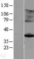 Western blot validation of overexpression lysate (Cat# LY406861) using anti-DDK antibody (Cat# TA50011-100). Left: Cell lysates from un-transfected HEK293T cells; Right: Cell lysates from HEK293T cells transfected with RC212885 using transfection reagent MegaTran 2.0 (Cat# TT210002).