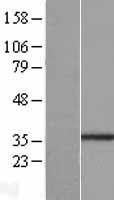 Western blot validation of overexpression lysate (Cat# LY406973) using anti-DDK antibody (Cat# TA50011-100). Left: Cell lysates from un-transfected HEK293T cells; Right: Cell lysates from HEK293T cells transfected with RC206225 using transfection reagent MegaTran 2.0 (Cat# TT210002).