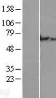 Western blot validation of overexpression lysate (Cat# LY407553) using anti-DDK antibody (Cat# TA50011-100). Left: Cell lysates from un-transfected HEK293T cells; Right: Cell lysates from HEK293T cells transfected with RC206115 using transfection reagent MegaTran 2.0 (Cat# TT210002).