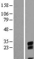 Western blot validation of overexpression lysate (Cat# LY410011) using anti-DDK antibody (Cat# TA50011-100). Left: Cell lysates from un-transfected HEK293T cells; Right: Cell lysates from HEK293T cells transfected with RC205959 using transfection reagent MegaTran 2.0 (Cat# TT210002).