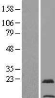 Western blot validation of overexpression lysate (Cat# LY405496) using anti-DDK antibody (Cat# TA50011-100). Left: Cell lysates from un-transfected HEK293T cells; Right: Cell lysates from HEK293T cells transfected with RC206932 using transfection reagent MegaTran 2.0 (Cat# TT210002).