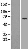 Western blot validation of overexpression lysate (Cat# LY406013) using anti-DDK antibody (Cat# TA50011-100). Left: Cell lysates from un-transfected HEK293T cells; Right: Cell lysates from HEK293T cells transfected with RC206914 using transfection reagent MegaTran 2.0 (Cat# TT210002).