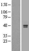 Western blot validation of overexpression lysate (Cat# LY407556) using anti-DDK antibody (Cat# TA50011-100). Left: Cell lysates from un-transfected HEK293T cells; Right: Cell lysates from HEK293T cells transfected with RC206964 using transfection reagent MegaTran 2.0 (Cat# TT210002).