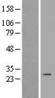 Western blot validation of overexpression lysate (Cat# LY407486) using anti-DDK antibody (Cat# TA50011-100). Left: Cell lysates from un-transfected HEK293T cells; Right: Cell lysates from HEK293T cells transfected with RC206352 using transfection reagent MegaTran 2.0 (Cat# TT210002).