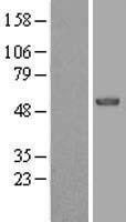 Western blot validation of overexpression lysate (Cat# LY410095) using anti-DDK antibody (Cat# TA50011-100). Left: Cell lysates from un-transfected HEK293T cells; Right: Cell lysates from HEK293T cells transfected with RC203800 using transfection reagent MegaTran 2.0 (Cat# TT210002).