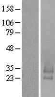 Western blot validation of overexpression lysate (Cat# LY405486) using anti-DDK antibody (Cat# TA50011-100). Left: Cell lysates from un-transfected HEK293T cells; Right: Cell lysates from HEK293T cells transfected with RC204586 using transfection reagent MegaTran 2.0 (Cat# TT210002).