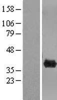 Western blot validation of overexpression lysate (Cat# LY404217) using anti-DDK antibody (Cat# TA50011-100). Left: Cell lysates from un-transfected HEK293T cells; Right: Cell lysates from HEK293T cells transfected with RC204554 using transfection reagent MegaTran 2.0 (Cat# TT210002).