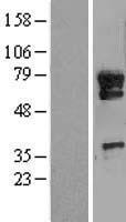 Western blot validation of overexpression lysate (Cat# LY414291) using anti-DDK antibody (Cat# TA50011-100). Left: Cell lysates from un-transfected HEK293T cells; Right: Cell lysates from HEK293T cells transfected with RC221362 using transfection reagent MegaTran 2.0 (Cat# TT210002).