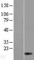 Western blot validation of overexpression lysate (Cat# LY411809) using anti-DDK antibody (Cat# TA50011-100). Left: Cell lysates from un-transfected HEK293T cells; Right: Cell lysates from HEK293T cells transfected with RC204395 using transfection reagent MegaTran 2.0 (Cat# TT210002).