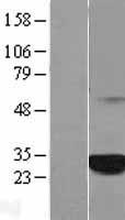 Western blot validation of overexpression lysate (Cat# LY407621) using anti-DDK antibody (Cat# TA50011-100). Left: Cell lysates from un-transfected HEK293T cells; Right: Cell lysates from HEK293T cells transfected with RC205153 using transfection reagent MegaTran 2.0 (Cat# TT210002).