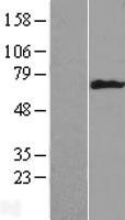 Western blot validation of overexpression lysate (Cat# LY417233) using anti-DDK antibody (Cat# TA50011-100). Left: Cell lysates from un-transfected HEK293T cells; Right: Cell lysates from HEK293T cells transfected with RC205139 using transfection reagent MegaTran 2.0 (Cat# TT210002).