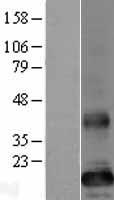 Western blot validation of overexpression lysate (Cat# LY406416) using anti-DDK antibody (Cat# TA50011-100). Left: Cell lysates from un-transfected HEK293T cells; Right: Cell lysates from HEK293T cells transfected with RC205798 using transfection reagent MegaTran 2.0 (Cat# TT210002).