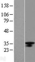 Western blot validation of overexpression lysate (Cat# LY423557) using anti-DDK antibody (Cat# TA50011-100). Left: Cell lysates from un-transfected HEK293T cells; Right: Cell lysates from HEK293T cells transfected with RC206663 using transfection reagent MegaTran 2.0 (Cat# TT210002).