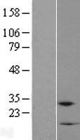 Western blot validation of overexpression lysate (Cat# LY407163) using anti-DDK antibody (Cat# TA50011-100). Left: Cell lysates from un-transfected HEK293T cells; Right: Cell lysates from HEK293T cells transfected with RC206790 using transfection reagent MegaTran 2.0 (Cat# TT210002).