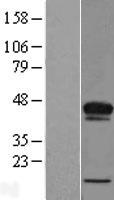 Western blot validation of overexpression lysate (Cat# LY427679) using anti-DDK antibody (Cat# TA50011-100). Left: Cell lysates from un-transfected HEK293T cells; Right: Cell lysates from HEK293T cells transfected with RC227776 using transfection reagent MegaTran 2.0 (Cat# TT210002).