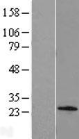 Western blot validation of overexpression lysate (Cat# LY407650) using anti-DDK antibody (Cat# TA50011-100). Left: Cell lysates from un-transfected HEK293T cells; Right: Cell lysates from HEK293T cells transfected with RC206726 using transfection reagent MegaTran 2.0 (Cat# TT210002).