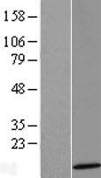 Western blot validation of overexpression lysate (Cat# LY423217) using anti-DDK antibody (Cat# TA50011-100). Left: Cell lysates from un-transfected HEK293T cells; Right: Cell lysates from HEK293T cells transfected with RC206796 using transfection reagent MegaTran 2.0 (Cat# TT210002).