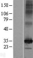 Western blot validation of overexpression lysate (Cat# LY413498) using anti-DDK antibody (Cat# TA50011-100). Left: Cell lysates from un-transfected HEK293T cells; Right: Cell lysates from HEK293T cells transfected with RC206986 using transfection reagent MegaTran 2.0 (Cat# TT210002).