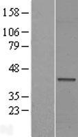 Western blot validation of overexpression lysate (Cat# LY410014) using anti-DDK antibody (Cat# TA50011-100). Left: Cell lysates from un-transfected HEK293T cells; Right: Cell lysates from HEK293T cells transfected with RC206387 using transfection reagent MegaTran 2.0 (Cat# TT210002).