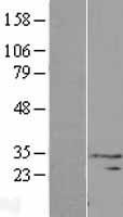 Western blot validation of overexpression lysate (Cat# LY406577) using anti-DDK antibody (Cat# TA50011-100). Left: Cell lysates from un-transfected HEK293T cells; Right: Cell lysates from HEK293T cells transfected with RC206739 using transfection reagent MegaTran 2.0 (Cat# TT210002).