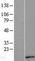Western blot validation of overexpression lysate (Cat# LY422818) using anti-DDK antibody (Cat# TA50011-100). Left: Cell lysates from un-transfected HEK293T cells; Right: Cell lysates from HEK293T cells transfected with RC206693 using transfection reagent MegaTran 2.0 (Cat# TT210002).