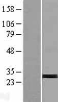 Western blot validation of overexpression lysate (Cat# LY424137) using anti-DDK antibody (Cat# TA50011-100). Left: Cell lysates from un-transfected HEK293T cells; Right: Cell lysates from HEK293T cells transfected with RC206694 using transfection reagent MegaTran 2.0 (Cat# TT210002).