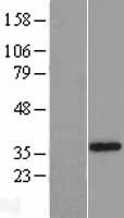 Western blot validation of overexpression lysate (Cat# LY407350) using anti-DDK antibody (Cat# TA50011-100). Left: Cell lysates from un-transfected HEK293T cells; Right: Cell lysates from HEK293T cells transfected with RC206966 using transfection reagent MegaTran 2.0 (Cat# TT210002).