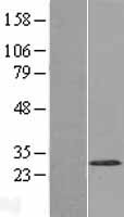 Western blot validation of overexpression lysate (Cat# LY407469) using anti-DDK antibody (Cat# TA50011-100). Left: Cell lysates from un-transfected HEK293T cells; Right: Cell lysates from HEK293T cells transfected with RC207050 using transfection reagent MegaTran 2.0 (Cat# TT210002).
