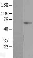 Western blot validation of overexpression lysate (Cat# LY422714) using anti-DDK antibody (Cat# TA50011-100). Left: Cell lysates from un-transfected HEK293T cells; Right: Cell lysates from HEK293T cells transfected with RC207165 using transfection reagent MegaTran 2.0 (Cat# TT210002).