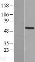 Western blot validation of overexpression lysate (Cat# LY408321) using anti-DDK antibody (Cat# TA50011-100). Left: Cell lysates from un-transfected HEK293T cells; Right: Cell lysates from HEK293T cells transfected with RC207674 using transfection reagent MegaTran 2.0 (Cat# TT210002).