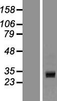Western blot validation of overexpression lysate (Cat# LY407505) using anti-DDK antibody (Cat# TA50011-100). Left: Cell lysates from un-transfected HEK293T cells; Right: Cell lysates from HEK293T cells transfected with RC207658 using transfection reagent MegaTran 2.0 (Cat# TT210002).